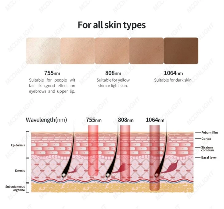 2400W Laser Hair Removal